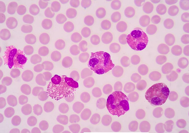 eosinofil