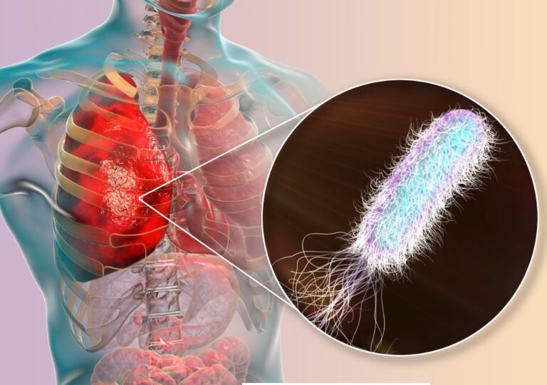 Bakteri Pseudomonas